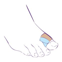 СТ-54.4 Межпальцевая перегородка с петлей