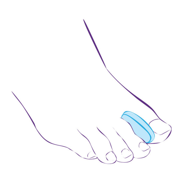 Межпальцевый вкладыш СТ-32  Trives